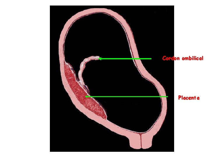 Cordon ombilical Placenta 