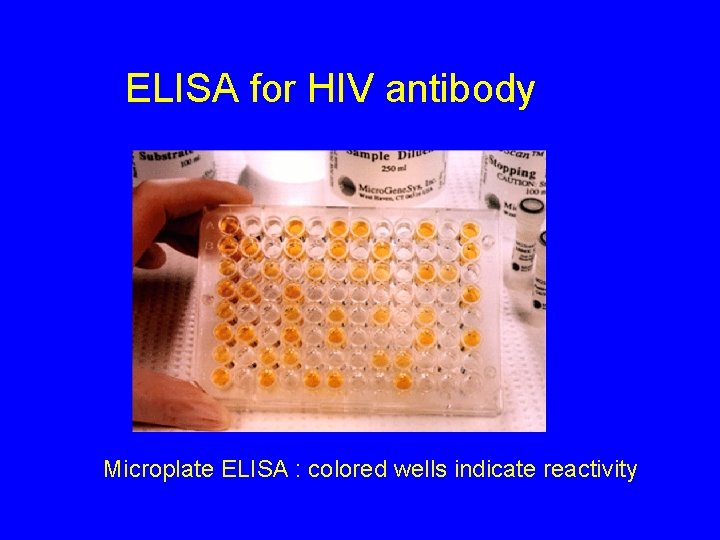 ELISA for HIV antibody Microplate ELISA : colored wells indicate reactivity 