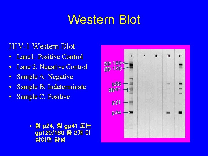 Western Blot HIV-1 Western Blot • • • Lane 1: Positive Control Lane 2: