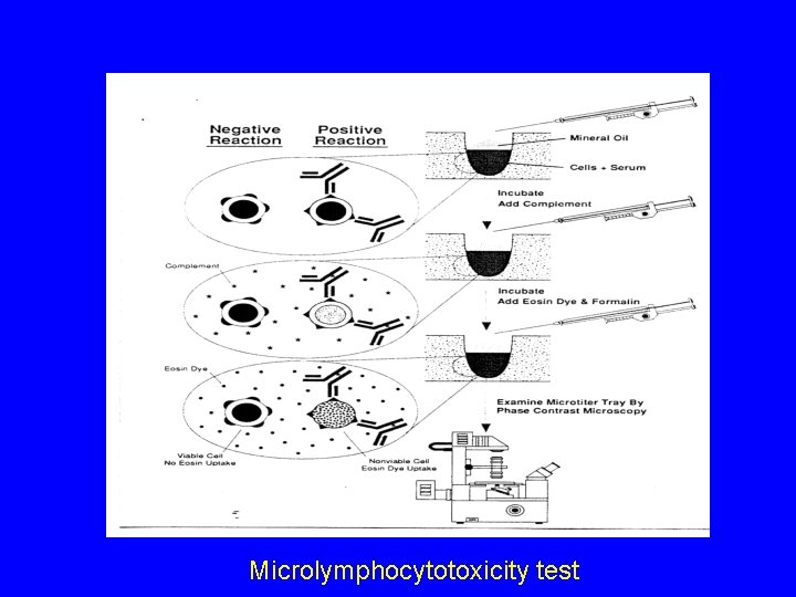 Microlymphocytotoxicity test 