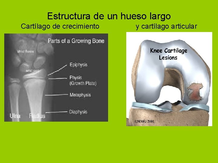 Estructura de un hueso largo Cartílago de crecimiento y cartílago articular 
