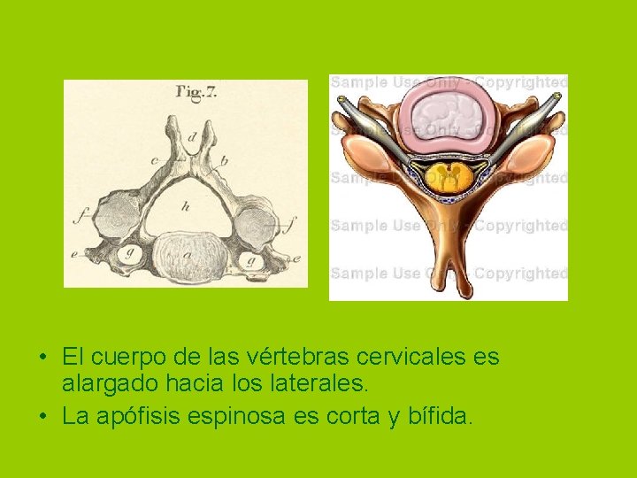  • El cuerpo de las vértebras cervicales es alargado hacia los laterales. •