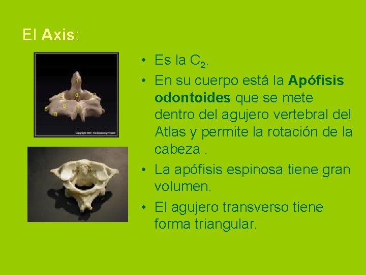 El Axis: • Es la C 2. • En su cuerpo está la Apófisis