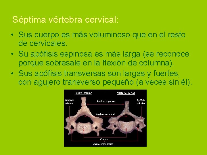 Séptima vértebra cervical: • Sus cuerpo es más voluminoso que en el resto de