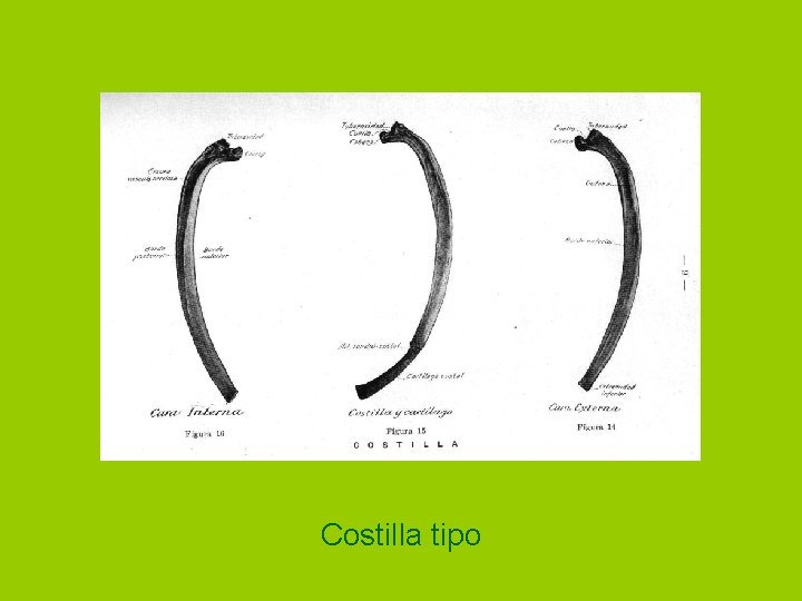 Costilla tipo 