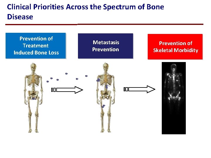 Clinical Priorities Across the Spectrum of Bone Disease Prevention of Treatment Induced Bone Loss