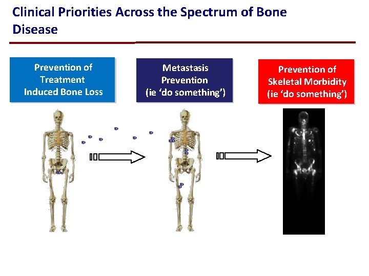 Clinical Priorities Across the Spectrum of Bone Disease Prevention of Treatment Induced Bone Loss