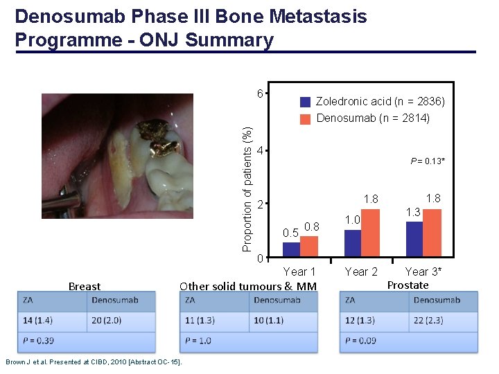 Denosumab Phase III Bone Metastasis Programme - ONJ Summary 6 Zoledronic acid (n =