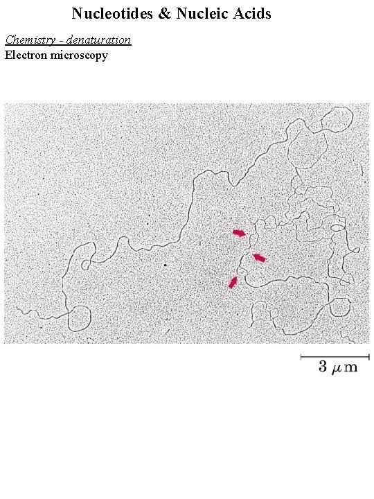 Nucleotides & Nucleic Acids Chemistry - denaturation Electron microscopy 