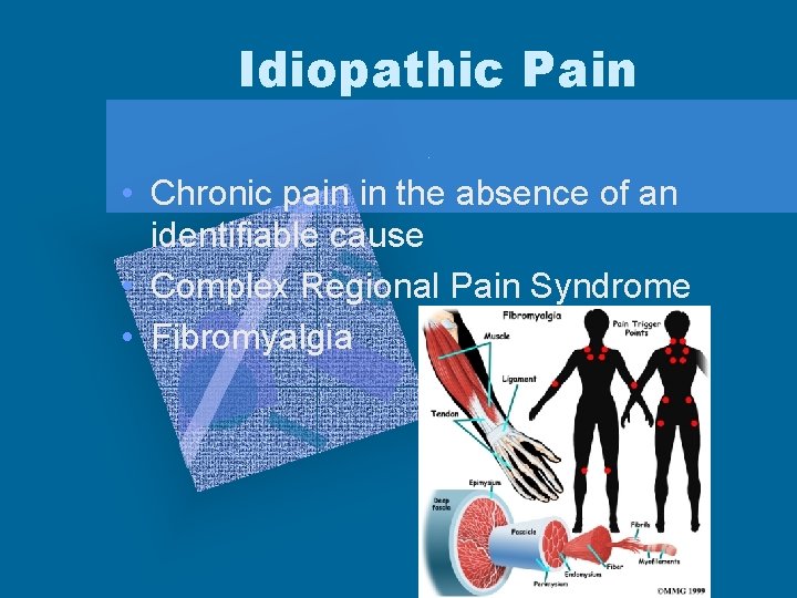 Idiopathic Pain • Chronic pain in the absence of an identifiable cause • Complex