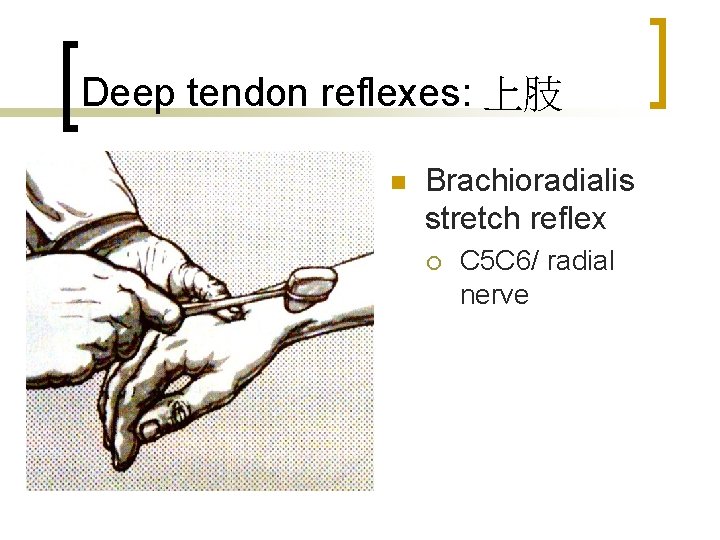 Deep tendon reflexes: 上肢 n Brachioradialis stretch reflex ¡ C 5 C 6/ radial