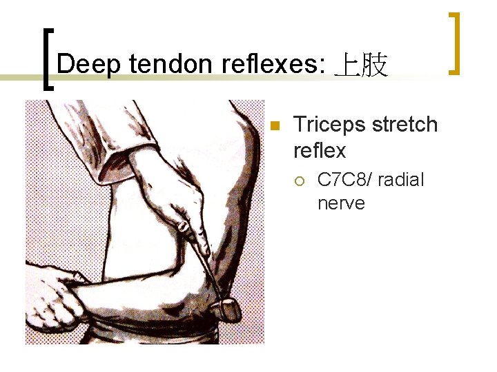 Deep tendon reflexes: 上肢 n Triceps stretch reflex ¡ C 7 C 8/ radial