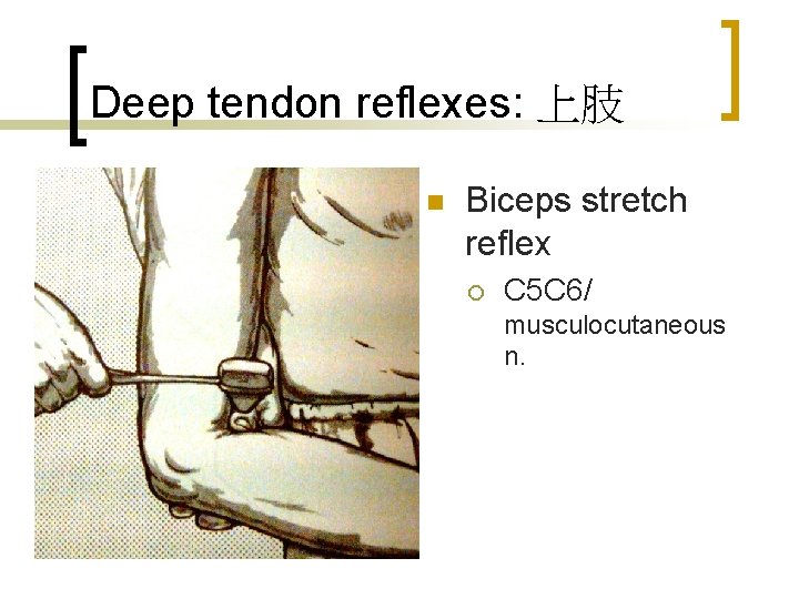 Deep tendon reflexes: 上肢 n Biceps stretch reflex ¡ C 5 C 6/ musculocutaneous