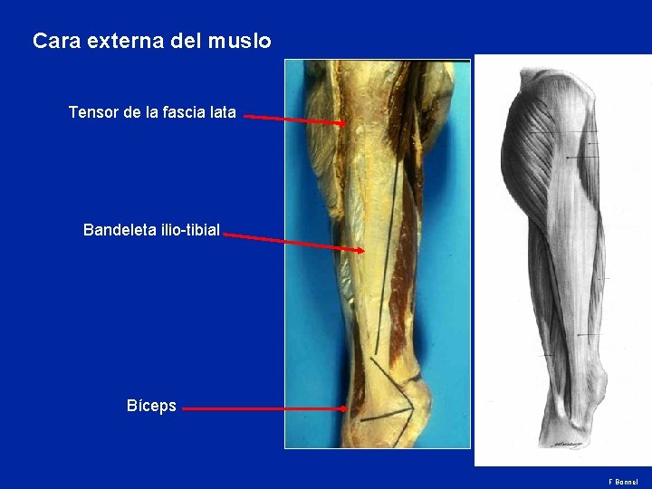 Cara externa del muslo Tensor de la fascia lata Bandeleta ilio-tibial Bíceps F Bonnel