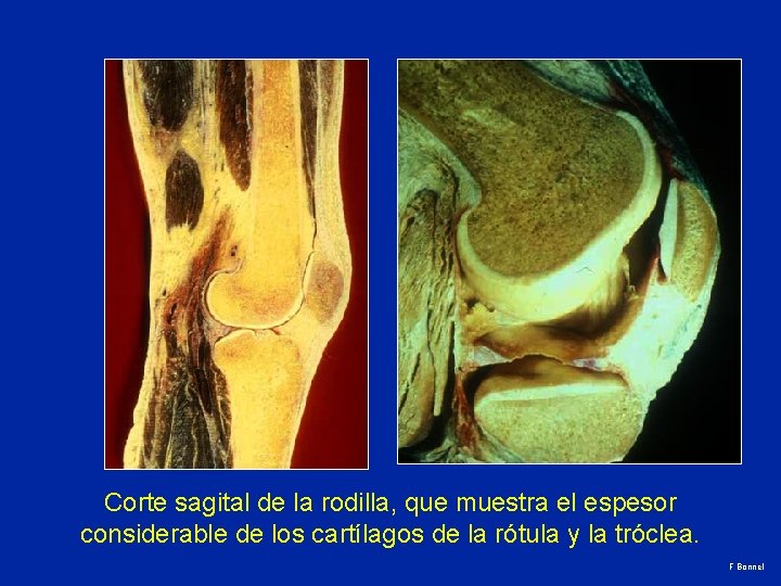 Corte sagital de la rodilla, que muestra el espesor considerable de los cartílagos de