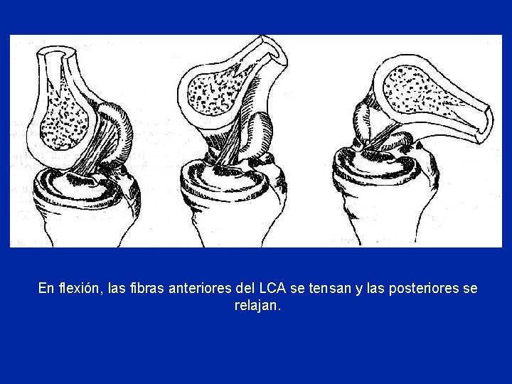 En flexión, las fibras anteriores del LCA se tensan y las posteriores se relajan.