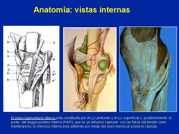 Anatomía: vistas internas El plano ligamentario interno esta constituido por el LLI profundo y