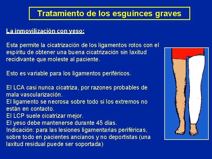 Tratamiento de los esguinces graves La inmovilización con yeso: Esta permite la cicatrización de