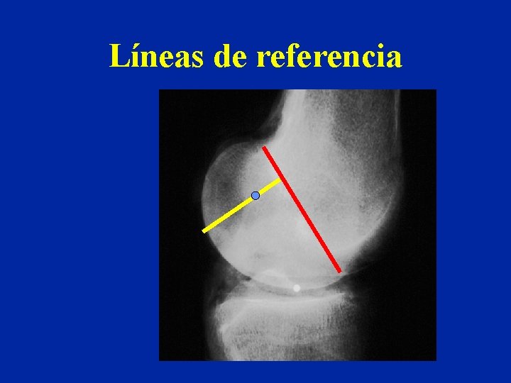 Líneas de referencia 