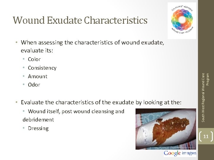 Wound Exudate Characteristics • • Color Consistency Amount Odor • Evaluate the characteristics of