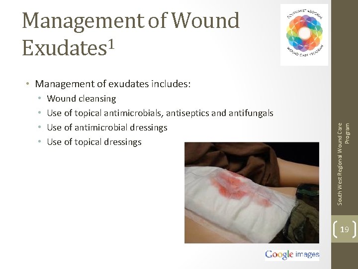 Management of Wound Exudates 1 • • Wound cleansing Use of topical antimicrobials, antiseptics