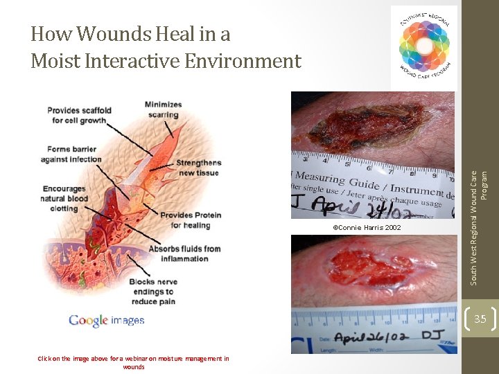 ©Connie Harris 2002 South West Regional Wound Care Program How Wounds Heal in a