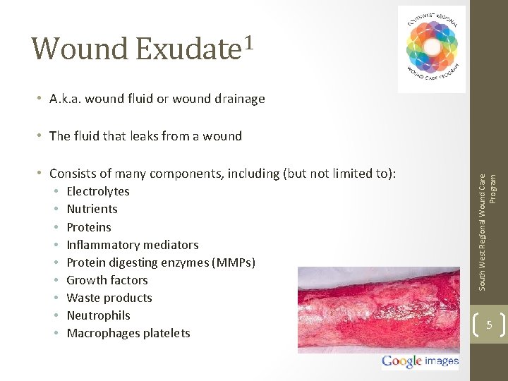 Wound Exudate 1 • A. k. a. wound fluid or wound drainage • Consists
