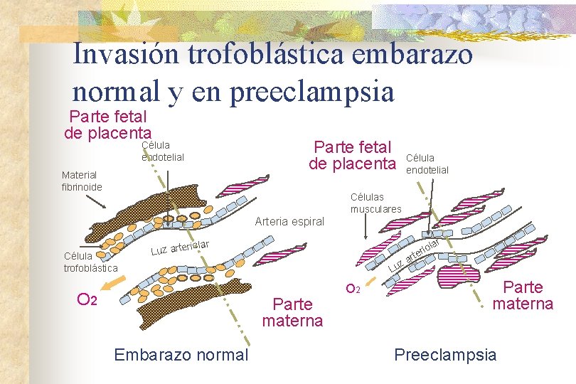Invasión trofoblástica embarazo normal y en preeclampsia Parte fetal de placenta Célula endotelial Material