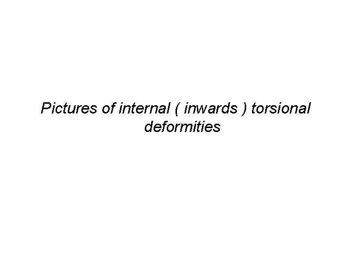 Pictures of internal ( inwards ) torsional deformities 