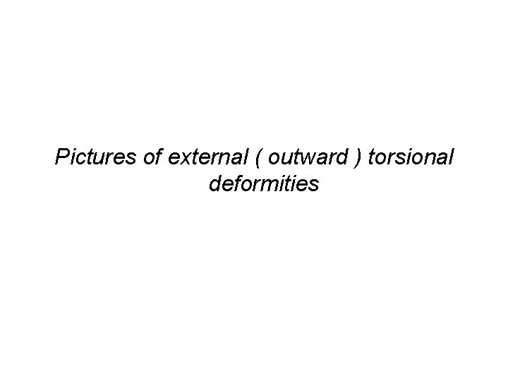 Pictures of external ( outward ) torsional deformities 