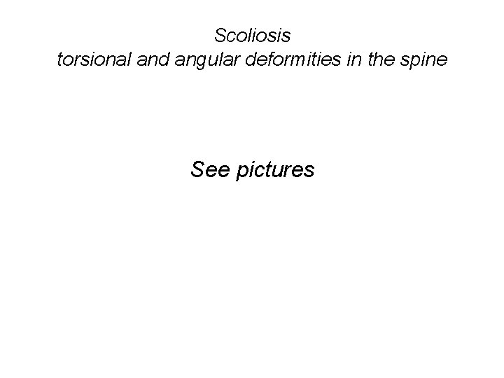 Scoliosis torsional and angular deformities in the spine See pictures 