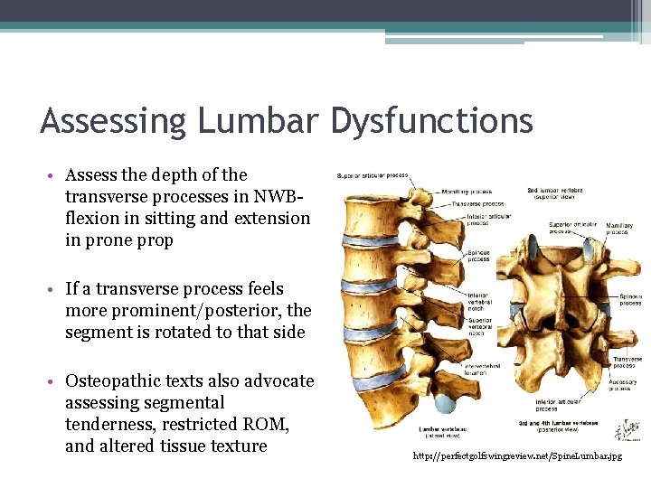 Assessing Lumbar Dysfunctions • Assess the depth of the transverse processes in NWBflexion in