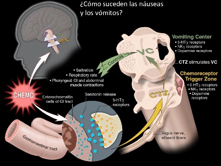 ¿Cómo suceden las náuseas y los vómitos? 