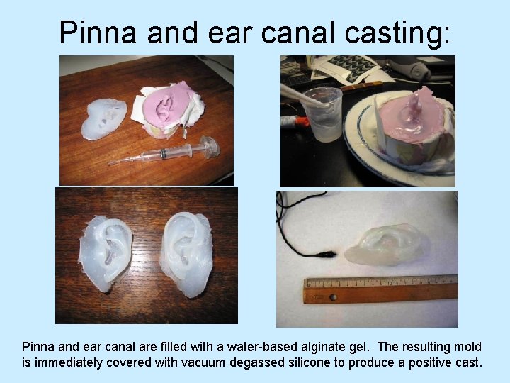 Pinna and ear canal casting: Pinna and ear canal are filled with a water-based