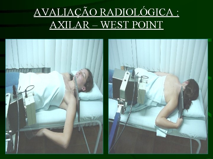 AVALIAÇÃO RADIOLÓGICA : AXILAR – WEST POINT 