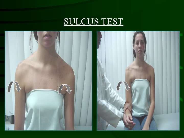 SULCUS TEST 