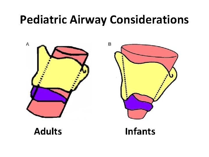 Pediatric Airway Considerations Adults Infants 