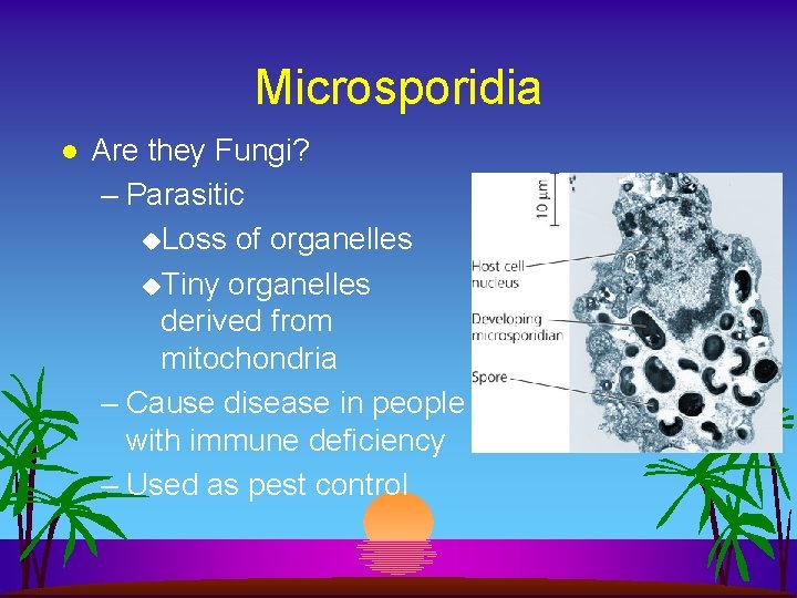 Microsporidia l Are they Fungi? – Parasitic u. Loss of organelles u. Tiny organelles