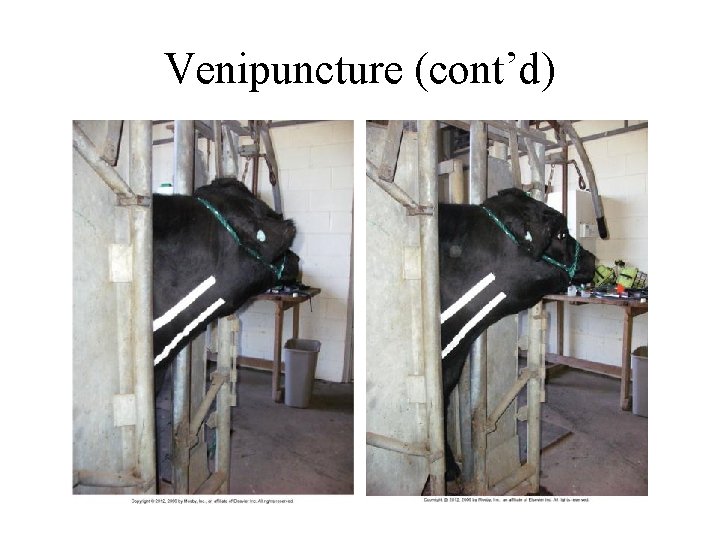 Venipuncture (cont’d) 