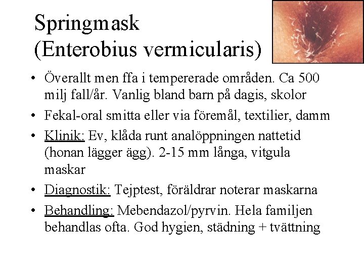 Springmask (Enterobius vermicularis) • Överallt men ffa i tempererade områden. Ca 500 milj fall/år.