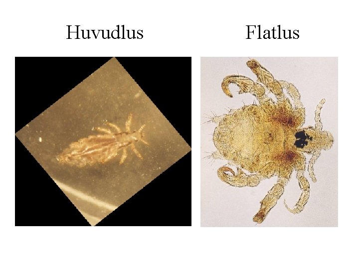 Huvudlus Flatlus 