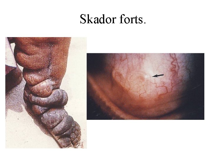 Skador forts. 