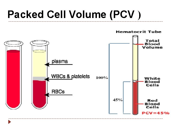 Packed Cell Volume (PCV ) 