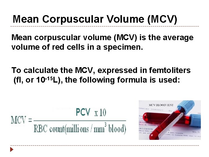 Mean Corpuscular Volume (MCV) Mean corpuscular volume (MCV) is the average volume of red