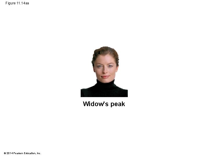 Figure 11. 14 aa Widow’s peak © 2014 Pearson Education, Inc. 