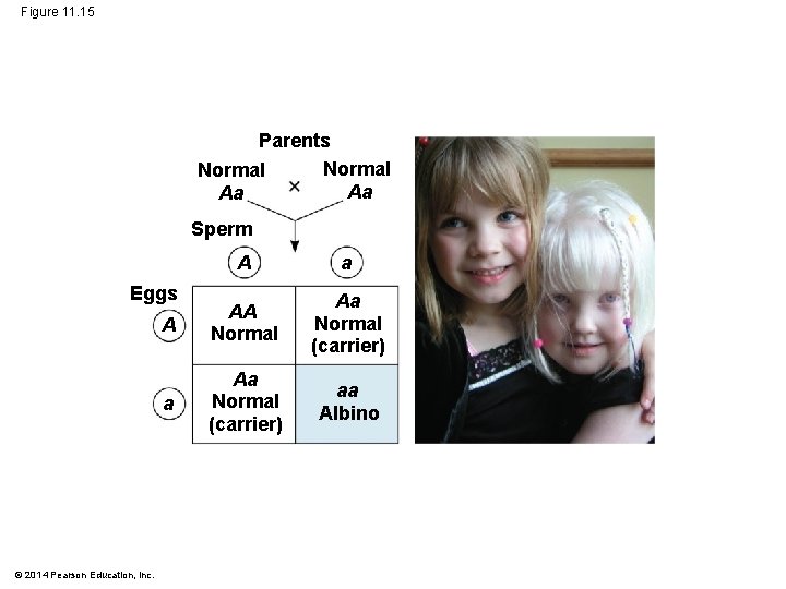 Figure 11. 15 Parents Normal Aa Aa Sperm A a A AA Normal Aa