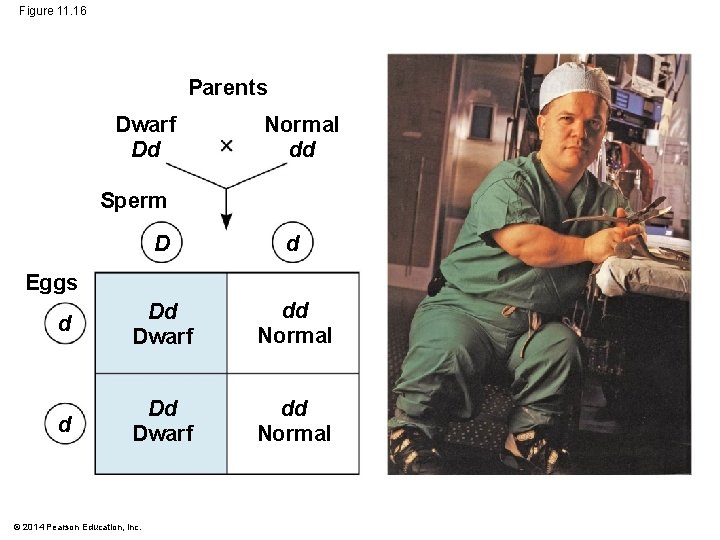 Figure 11. 16 Parents Dwarf Dd Normal dd Sperm D d d Dd Dwarf