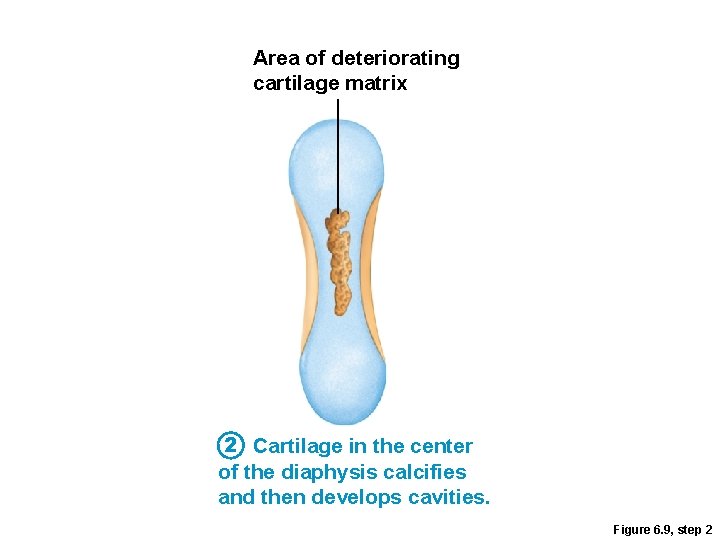 Area of deteriorating cartilage matrix 2 Cartilage in the center of the diaphysis calcifies