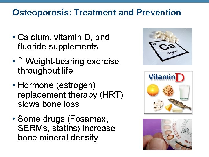 Osteoporosis: Treatment and Prevention • Calcium, vitamin D, and fluoride supplements • Weight-bearing exercise