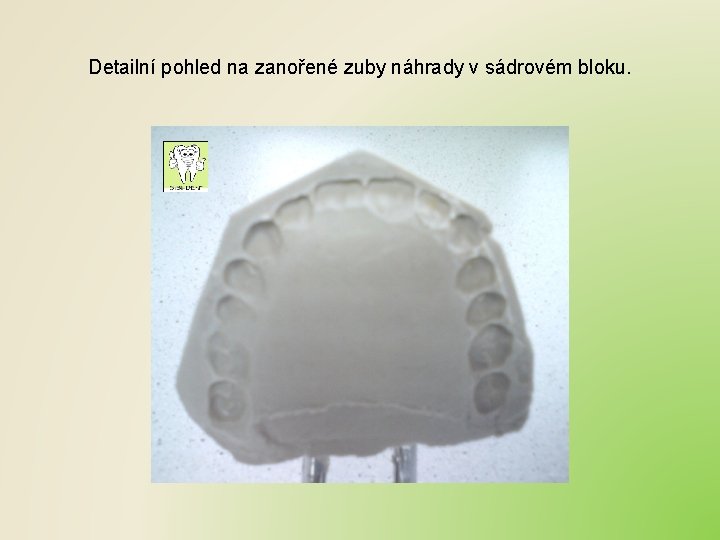 Detailní pohled na zanořené zuby náhrady v sádrovém bloku. 